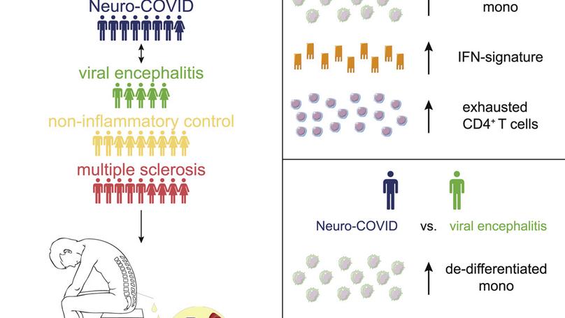 Neurological Manifestations of COVID-19 Feature T Cell Exhaustion and Dedifferentiated Monocytes in Cerebrospinal Fluid