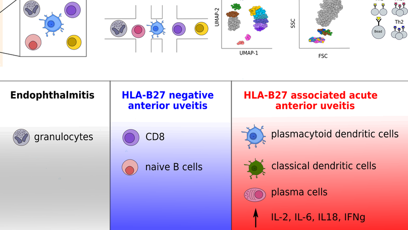 Intraocular dendritic cells characterize HLA-B27-associated acute anterior uveitis